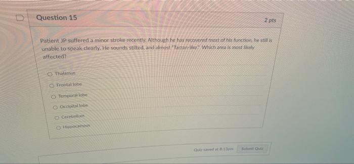 Question 1 Patient Lt Has Been Diagnosed With Schizophrenia Lt Frequently Hears Voices That Tell Him What To Do At Oth 15