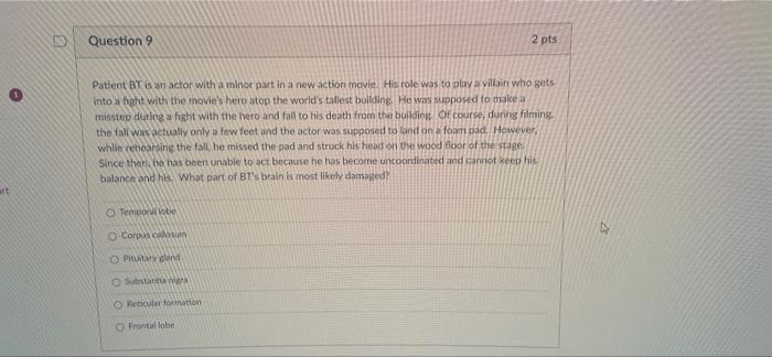 D Question 7 Patient Rt Unwisely Took A Popular Party Drug Which Affected Parts Of Her Brain Now She Cannot Conscious 3
