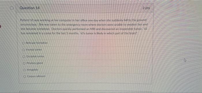 Corpus Callosum Question 13 Patient Pd Suffers From An Extreme Seizure Disorder Doctors Have Located The Source Of The 2