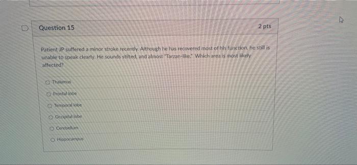 Corpus Callosum Question 13 Patient Pd Suffers From An Extreme Seizure Disorder Doctors Have Located The Source Of The 3