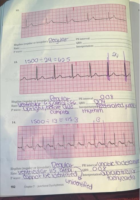 Rhython Regular Or Irregular Rate Pwave 13 Regular 14 Pr Interval Qrs Interpretation 1500 24625 Hhhh 008 Rhythm R 1