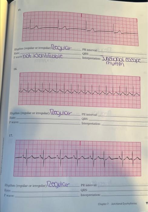 Rhython Regular Or Irregular Rate Pwave 13 Regular 14 Pr Interval Qrs Interpretation 1500 24625 Hhhh 008 Rhythm R 2