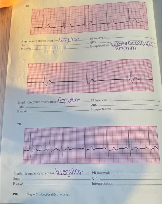 Rhythm Regular Or Irregular Egular Rate P Wave 19 18 Rhythm Regular Or Irregular Rate P Wave 20 194 Rhythm R 1