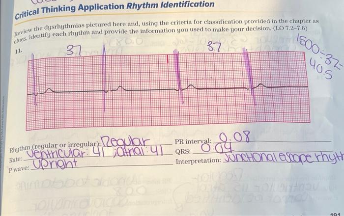 Rhythm Regular Or Irregular Egular Rate P Wave 19 18 Rhythm Regular Or Irregular Rate P Wave 20 194 Rhythm R 3