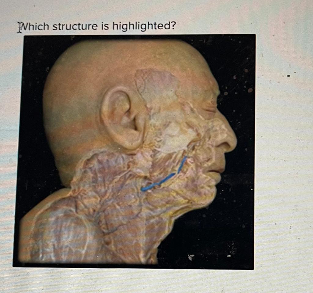 Which Structure Is Highlighted 1