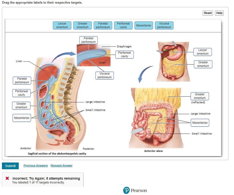 Drag The Appropriate Labels To Their Respective Targets Liver Parietal Peritoneum Peritoneal Cavity Greater Omentum Mes 1