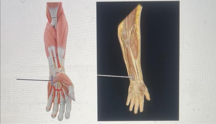 O O O O Brachial Artery Superficial Palmar Arch Common Digital Arteries Radial Artery Ulnar Artery 1