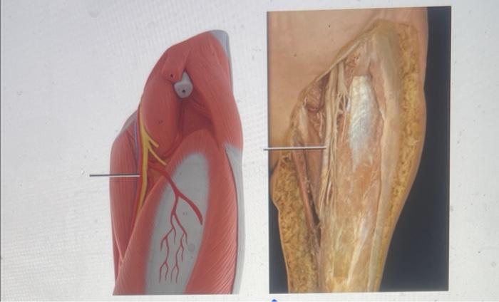 Descending Branch Of Lateral Circumflex Femoral Artery Femoral Artery Ascending Branch Of Lateral Circumflex Femoral Art 1