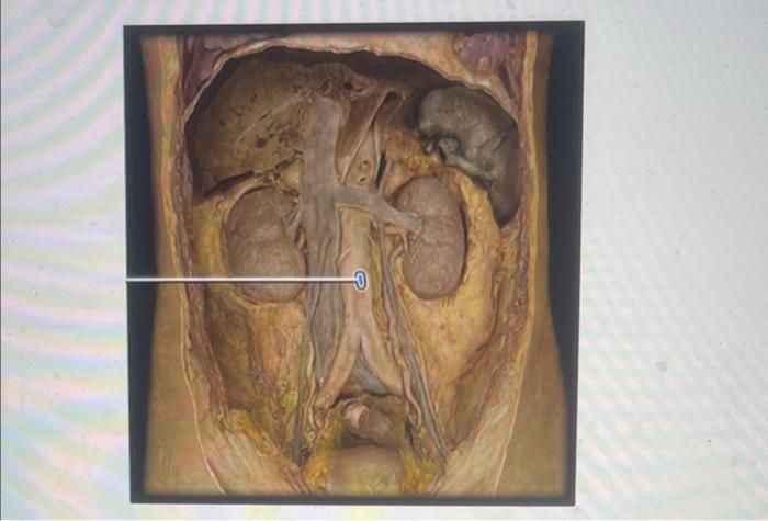 O O O O Aorta Inferior Mesenteric Artery Superior Mesenteric Artery Celiac Trunk 1