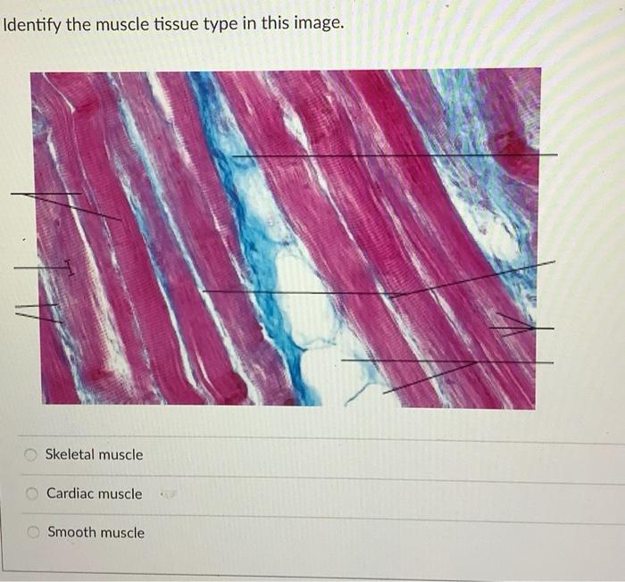Hematoxylin And Eosin Is The Most Common Staining Method Using Two Stains True False Name The Cell Type Seen In The Ma 3