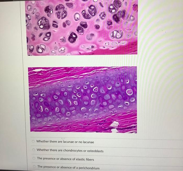 Hematoxylin And Eosin Is The Most Common Staining Method Using Two Stains True False Name The Cell Type Seen In The Ma 4
