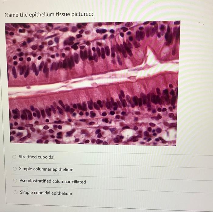 Name The Epithelium Tissue Pictured Mar Leno Stratified Cuboidal Simple Columnar Epithelium Pseudostratified Columnar C 1