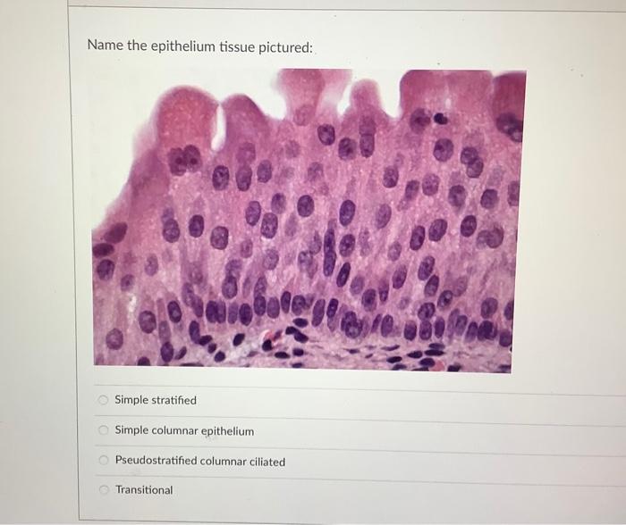 Name The Epithelium Tissue Pictured Mar Leno Stratified Cuboidal Simple Columnar Epithelium Pseudostratified Columnar C 2