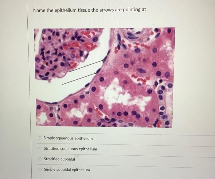 Name The Epithelium Tissue Pictured Mar Leno Stratified Cuboidal Simple Columnar Epithelium Pseudostratified Columnar C 3