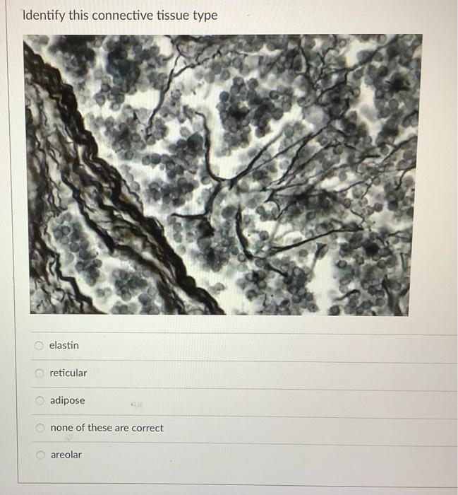 Name The Epithelium Tissue Pictured Mar Leno Stratified Cuboidal Simple Columnar Epithelium Pseudostratified Columnar C 4