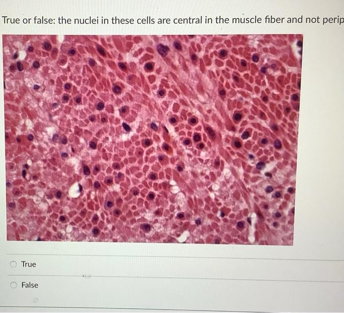 True Or False The Nuclei In These Cells Are Central In The Muscle Fiber And Not Perip True False The Alternating Light 1