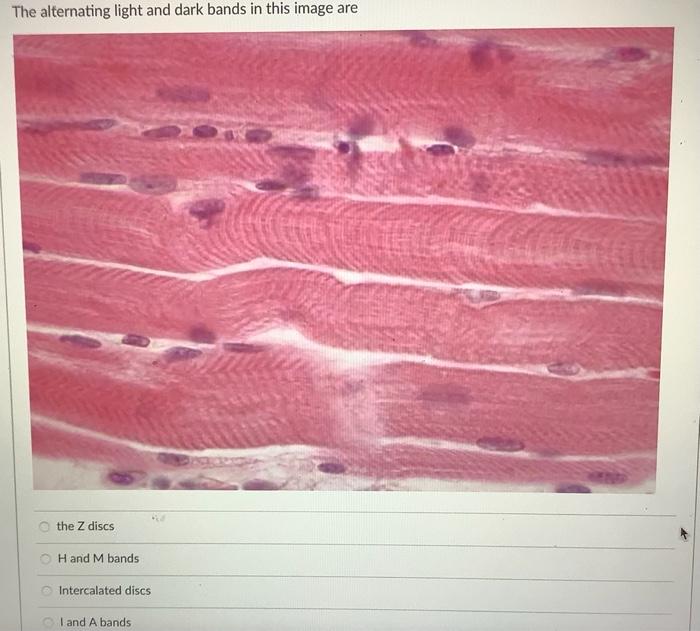 True Or False The Nuclei In These Cells Are Central In The Muscle Fiber And Not Perip True False The Alternating Light 2
