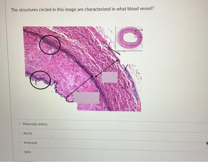 True Or False The Nuclei In These Cells Are Central In The Muscle Fiber And Not Perip True False The Alternating Light 3