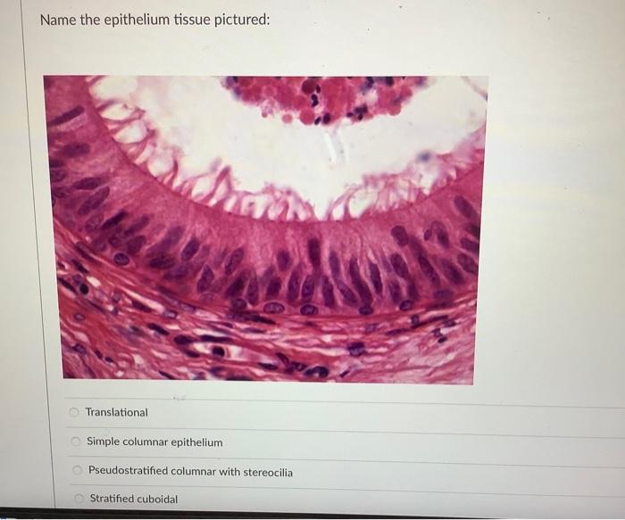 Name The Epithelium Tissue Pictured Translational And Simple Columnar Epithelium Pseudostratified Columnar With Stereoc 1