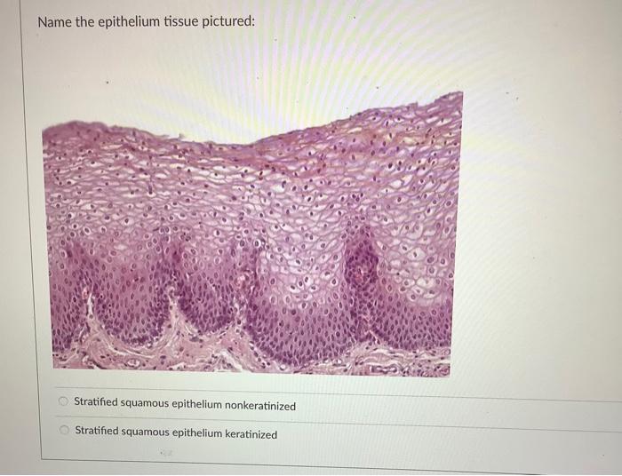 Name The Epithelium Tissue Pictured Translational And Simple Columnar Epithelium Pseudostratified Columnar With Stereoc 2