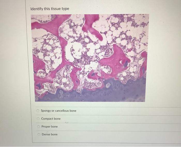 Name The Epithelium Tissue Pictured Translational And Simple Columnar Epithelium Pseudostratified Columnar With Stereoc 3
