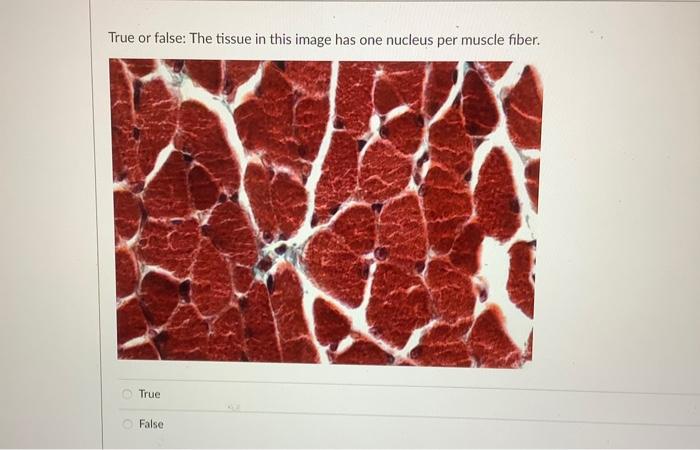 Name The Epithelium Tissue Pictured Translational And Simple Columnar Epithelium Pseudostratified Columnar With Stereoc 4