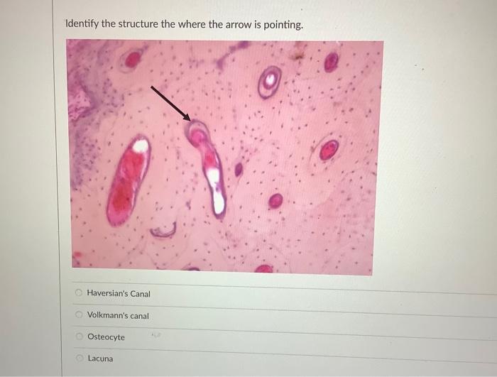 Identify The Structure The Arrows Are Pointing To Periosteum Trabeculae Osteon Ch No Answer Text Provided Chondroblas 4