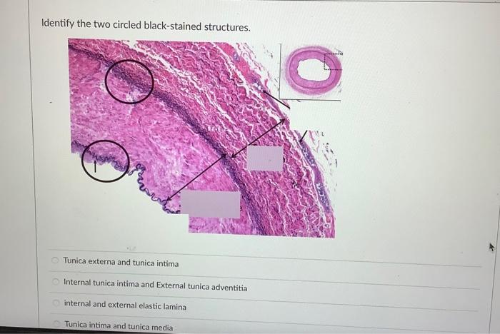 Identify The Two Circled Black Stained Structures Tunica Externa And Tunica Intima Internal Tunica Intima And External 1