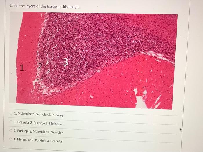 Identify The Two Circled Black Stained Structures Tunica Externa And Tunica Intima Internal Tunica Intima And External 4