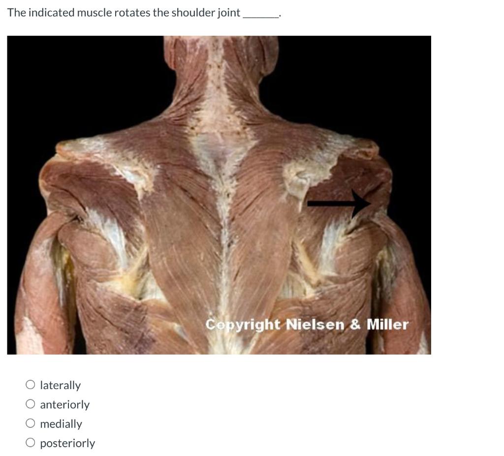 The Indicated Muscle Rotates The Shoulder Joint O Laterally Anteriorly Medially O Posteriorly Copyright Nielsen Miller 1