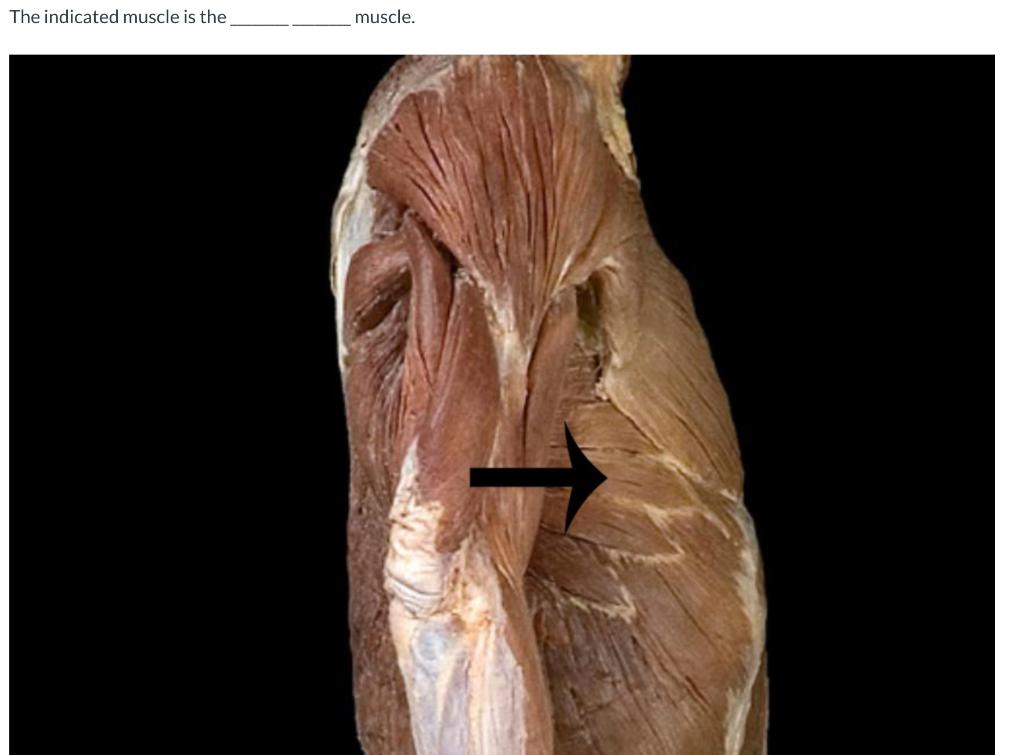 The Indicated Muscle Is The Muscle Serratus Anterior Internal Intercostal External Intercostal Serratus Posterior 1