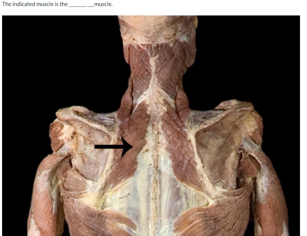 The Indicated Muscle Is The Muscle O Lower Trapezius O Rhomboid Major O Middle Trapezius O Rhomboid Minor 1