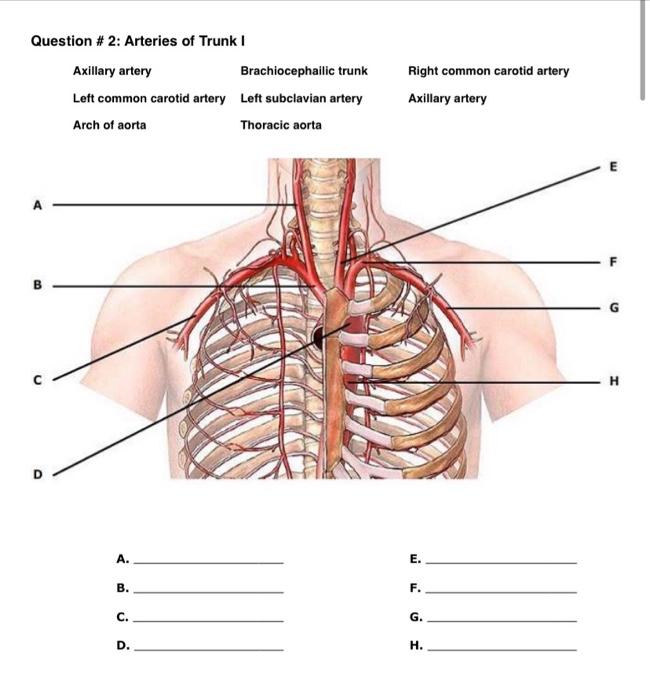Question 2 Arteries Of Trunk I Axillary Artery Brachiocephailic Trunk Left Common Carotid Artery Left Subclavian Arte 1