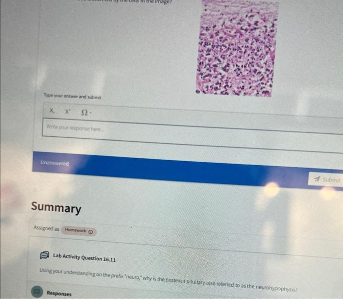 Type Your Answer And Submit S2 Write Your Response Here Unanswered Summary Assigned As Homework Image Lab Activity 1