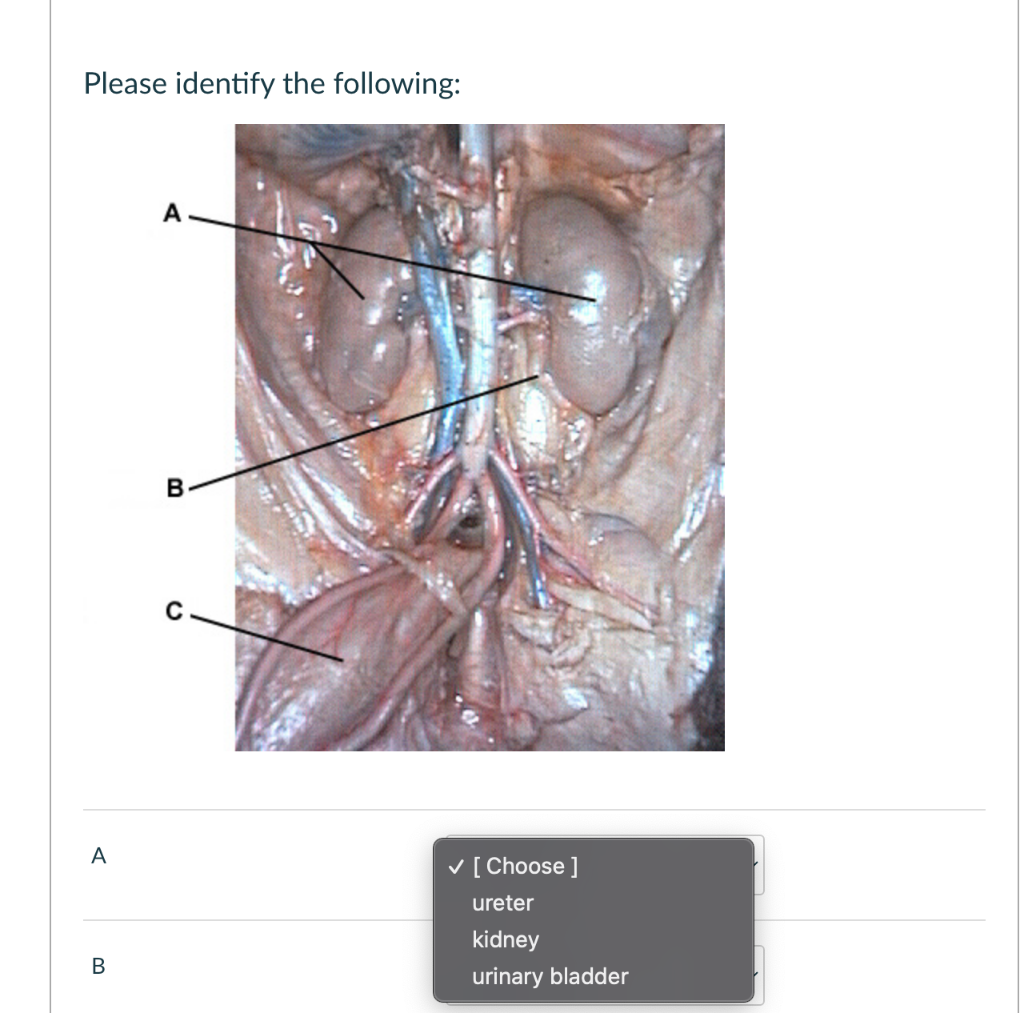 Please Identify The Following A B A B C Choose Ureter Kidney Urinary Bladder Please Identify The Female Reproduct 1