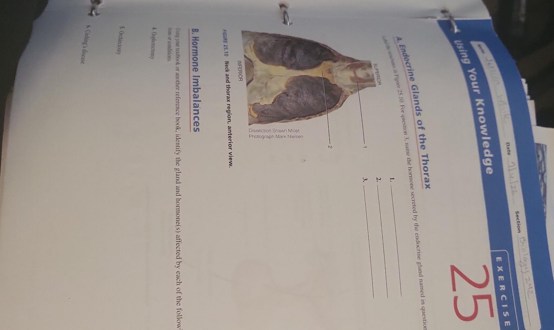 Www Janua Using Your Knowledge A Endocrine Glands Of The Thorax Label The Structures In Figure 25 10 For Question 3 1