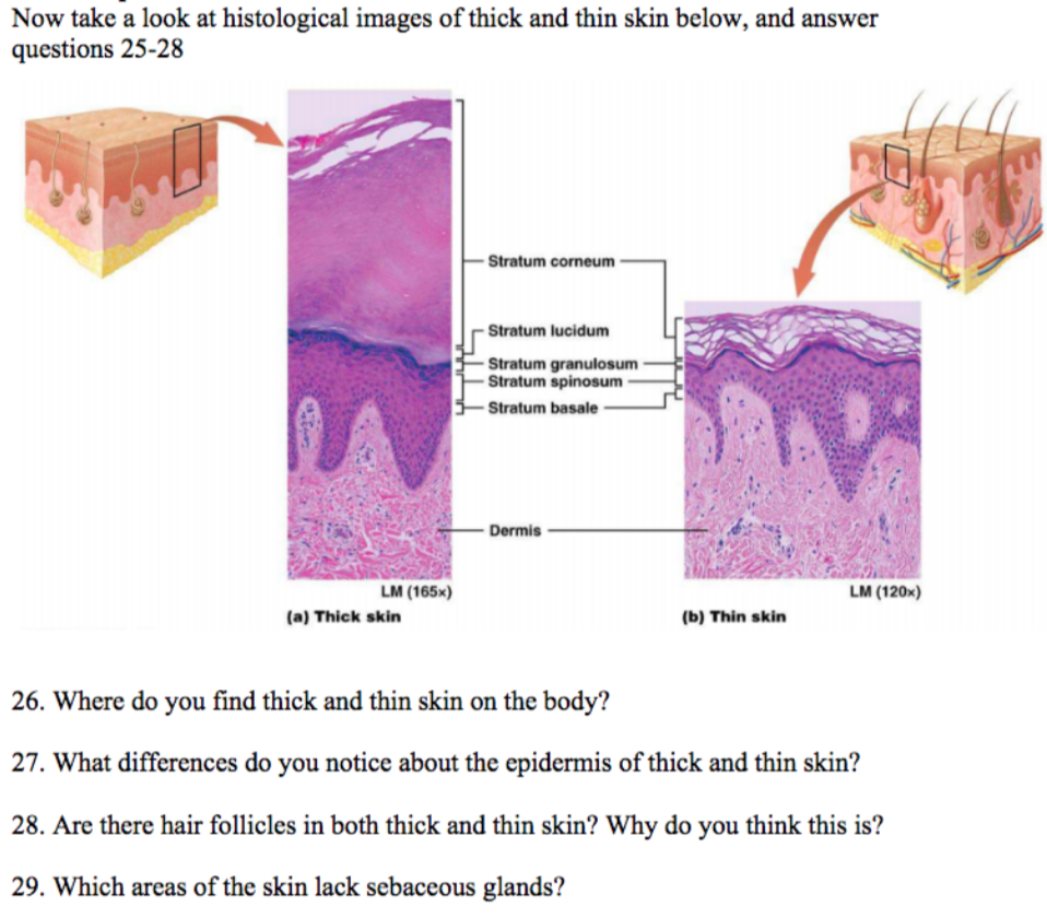 Now Take A Look At Histological Images Of Thick And Thin Skin Below And Answer Questions 25 28 Lm 165x A Thick Skin 1