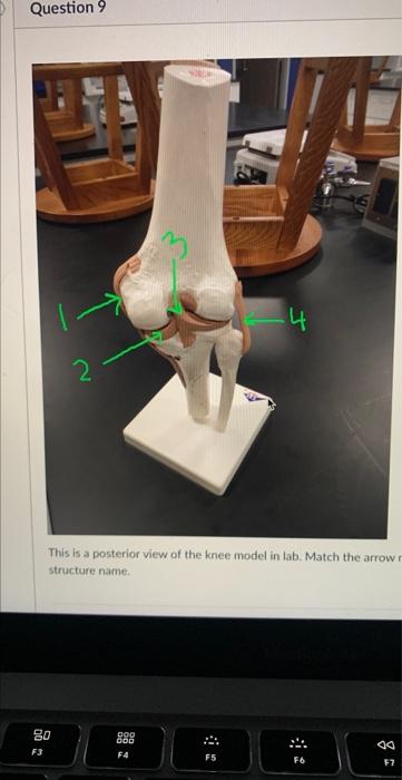 Question 9 2 80 F3 S This Is A Posterior View Of The Knee Model In Lab Match The Arrow R Structure Name 000 000 F4 4 1