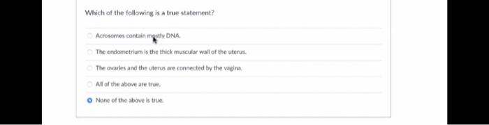 A Massive Decrease In Map Will Indirectly Lead To An Increase In Urine Output A Decrease In The Amount Of Adh Releas 2