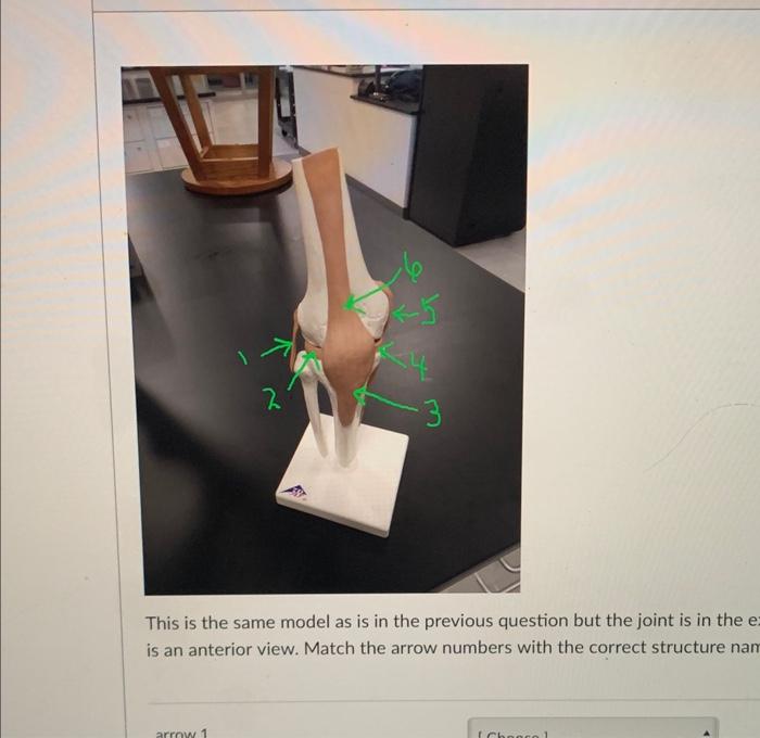 2 Arrow 1 3 This Is The Same Model As Is In The Previous Question But The Joint Is In The Ex Is An Anterior View Match 1