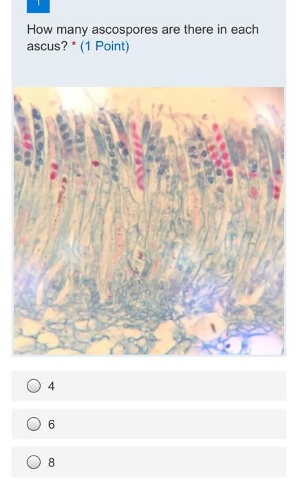How Many Ascospores Are There In Each Ascus 1 Point 4 6 8 1000004 1