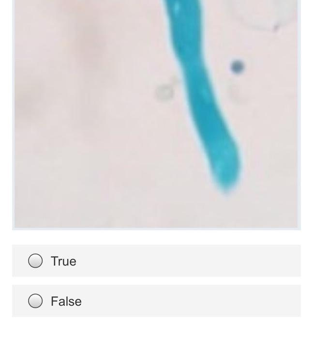 The Provided Fungi Reproduce By Conidiophore 1 Point O True False 2