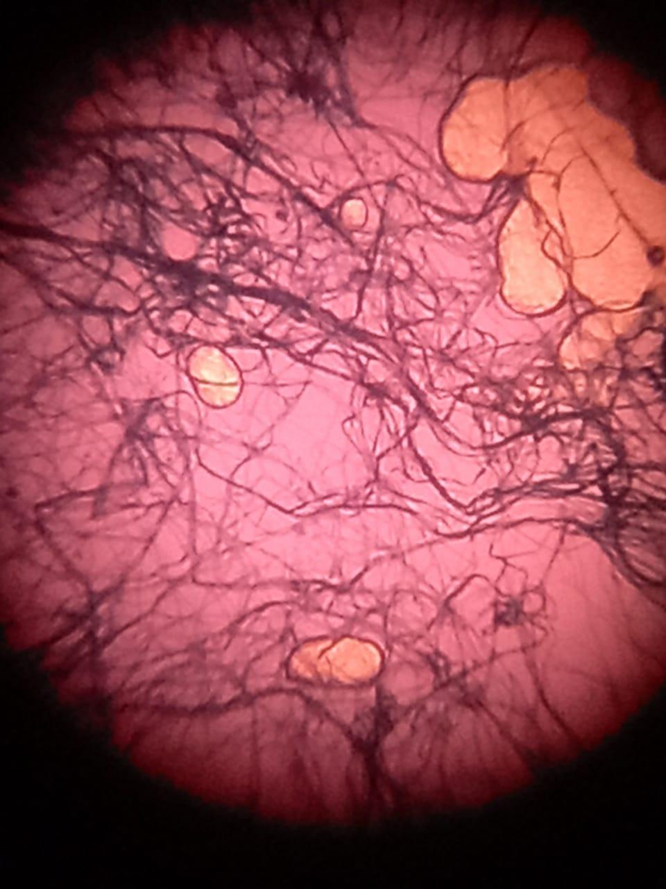 This Is Fungal Under Microscope From A Plant Leaf Disease It Was Infected Leaf In Ethanol That Was Put Under Microscop 1