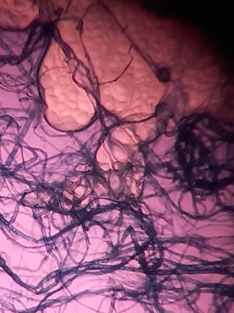 This Is Fungal Under Microscope From A Plant Leaf Disease It Was Infected Leaf In Ethanol That Was Put Under Microscop 2