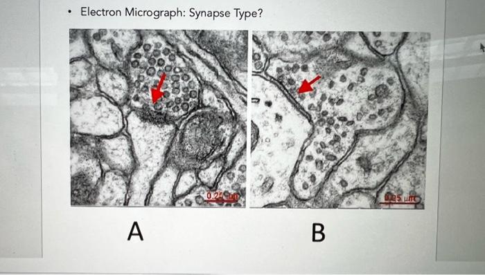 Electron Micrograph Synapse Type A B 25 Une 1