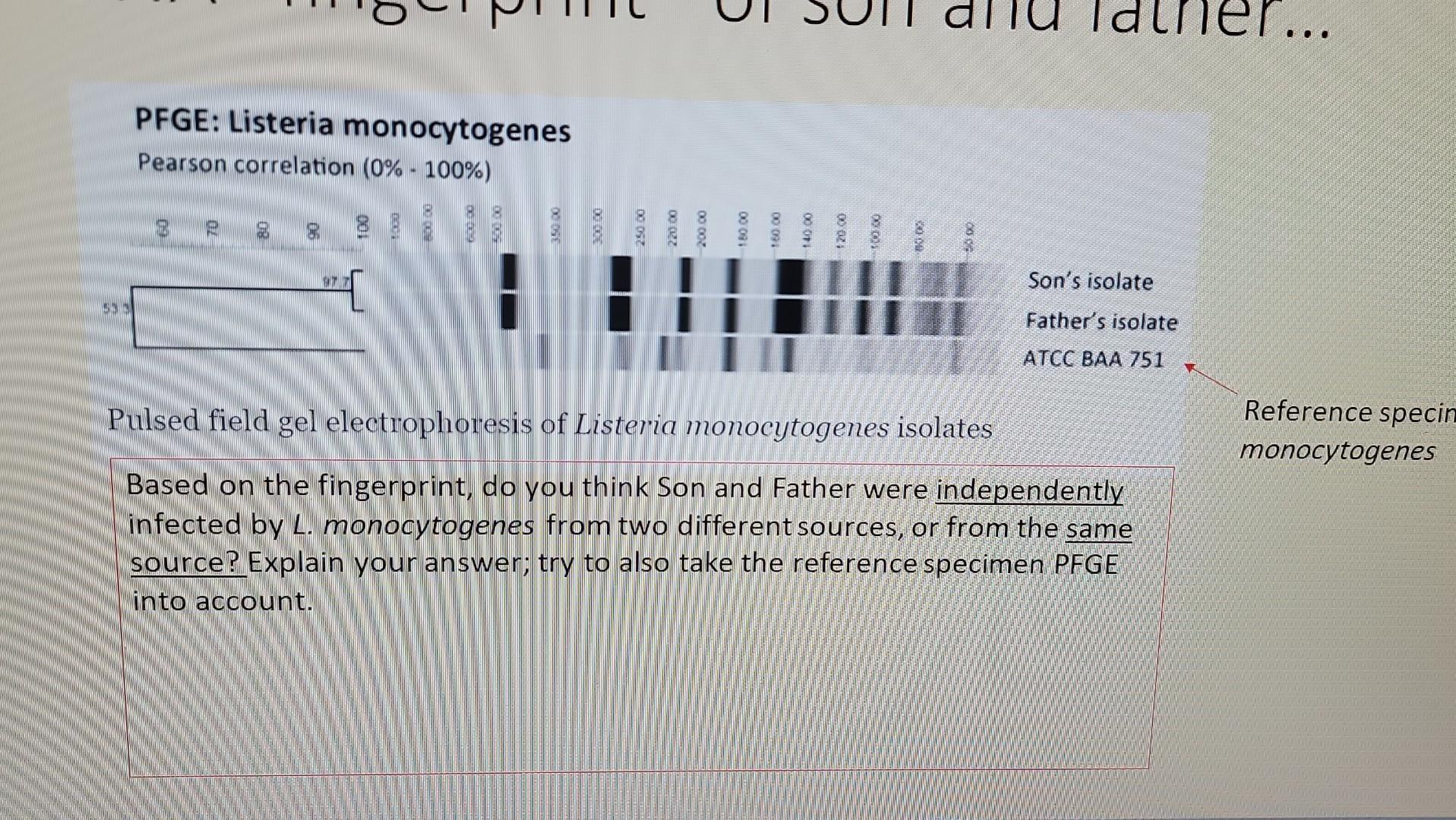 Based On The Fingerprint Do You Thim Son And Father Were Independently Infected By L Monocytogenes From Two Differe T 1