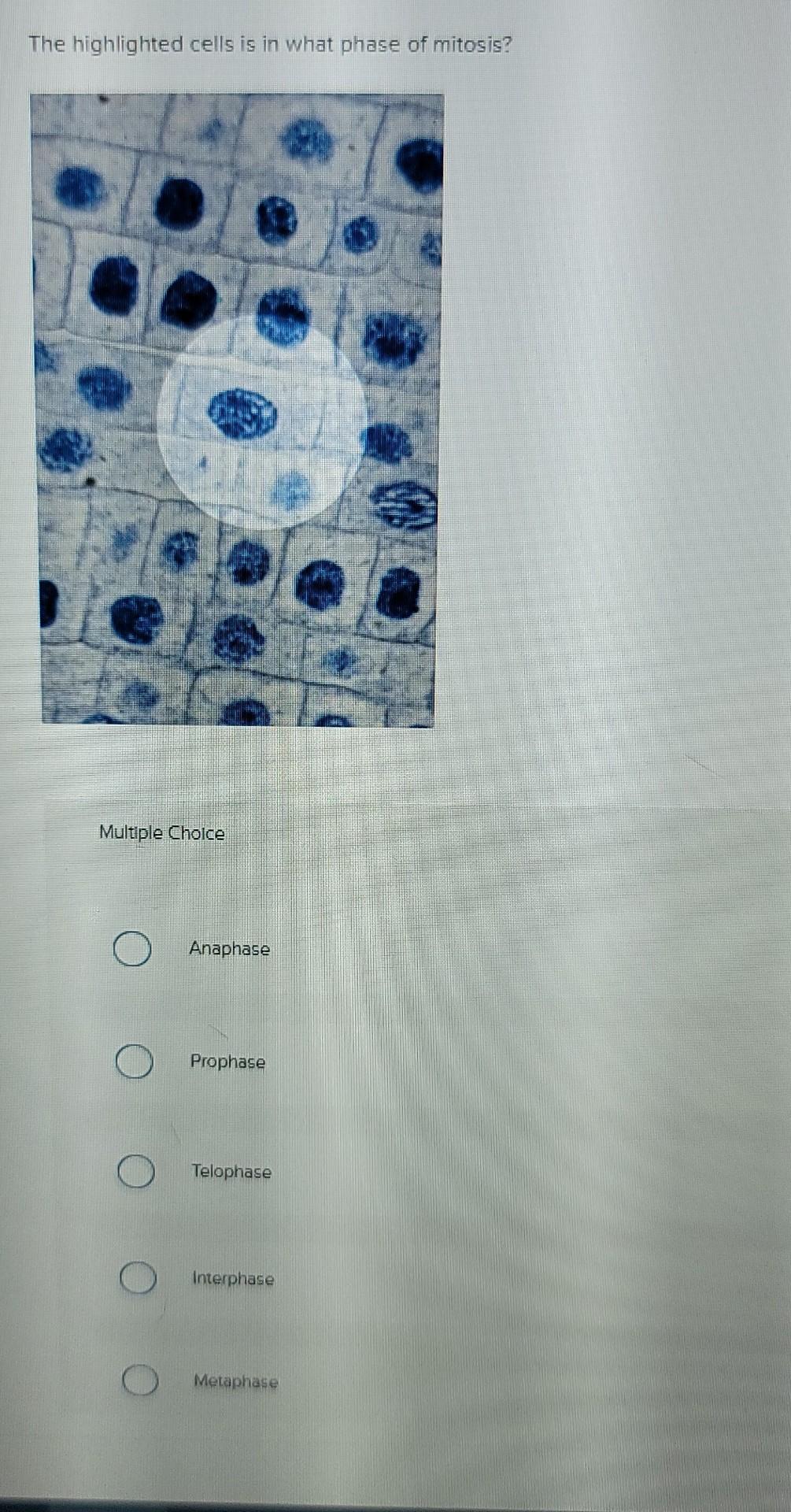 The Highlighted Cells Is In What Phase Of Mitosis Multiple Choice Anaphase Prophase Telophase Interphase Metaphase 1