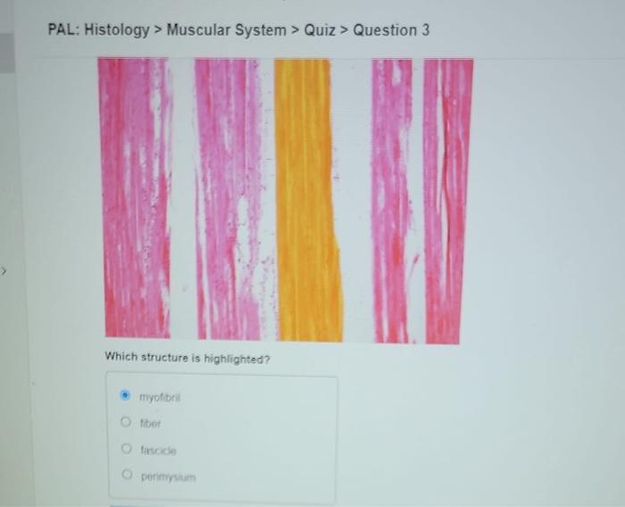 What Is A Function Of The Highlighted Muscle O Elevates Hyoid O Elevates Mandible Ofloxes Neck Depresses Hyoid Submit P 3