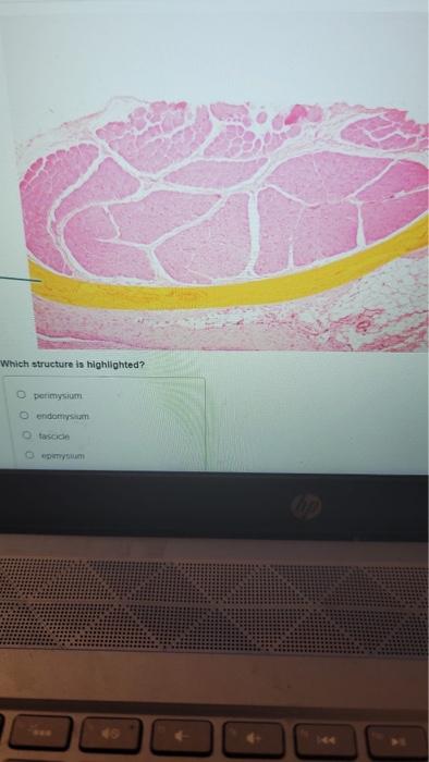 What Is A Function Of The Highlighted Muscle O Elevates Hyoid O Elevates Mandible Ofloxes Neck Depresses Hyoid Submit P 6
