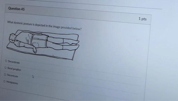 Question 45 What Dystoric Posture Is Depicted In The Image Provided Below O Decerebrate O Baul Piridion Hemiparesis 1 P 1